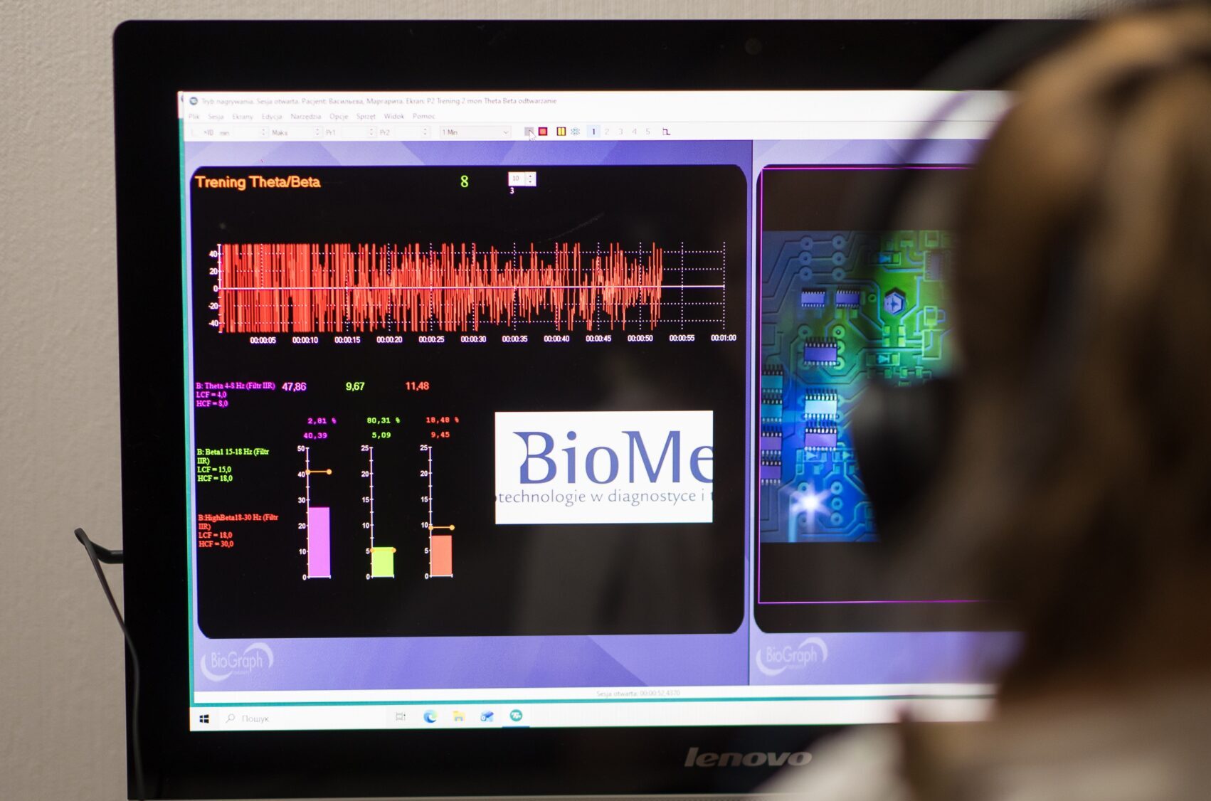 Пацієнт проходить процедуру biofeedback в офтальмологічній клініці для тренування зорової функції