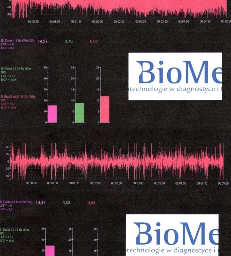 Екран системи Biofeedback під час тренування зорової функції пацієнта в офтальмологічній клініці